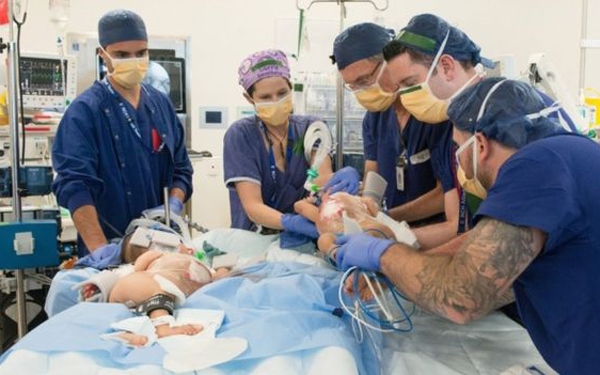 Bhutanese Conjoined Twins Separated Successfully At Australian Hospital