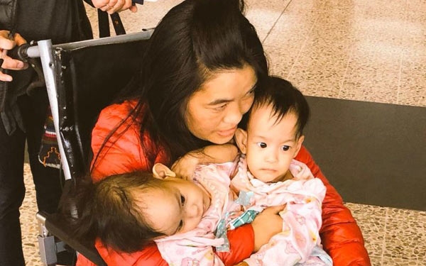 Conjoined Twins From Bhutan Arrive In Melbourne For 'Complex' Separation Surgery